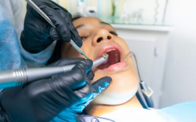 What You Should Do and What to Avoid Before a Dental Appointment