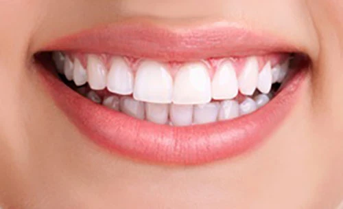 teeth whitening beverly hills