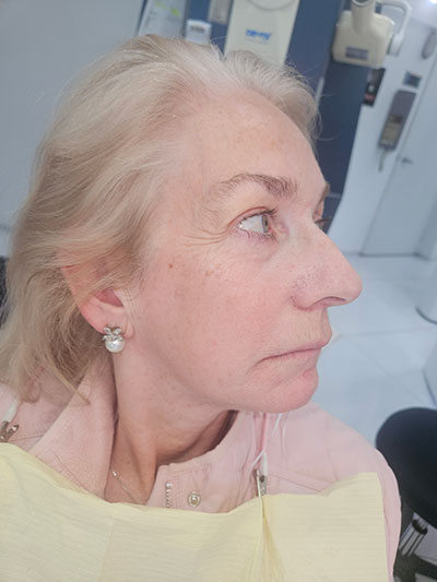 bef-face-dentistry Before FACE Dentistry
