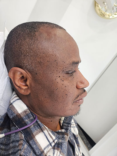 bef-jaw-position-correction Before Jaw Position Correction