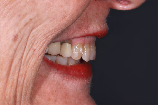 face-dentistry-before Before FACE Dentistry