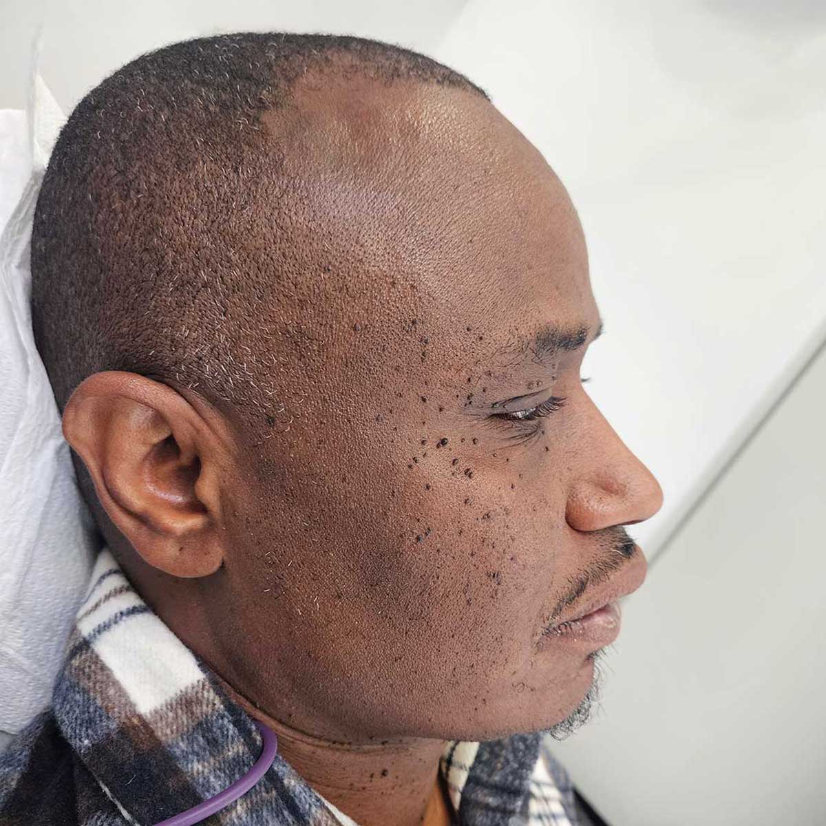 bef-jaw-position-correction Before Jaw Position Correction