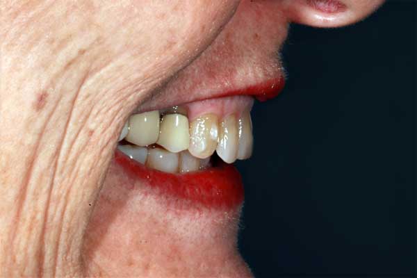 FACE Dentistry Before