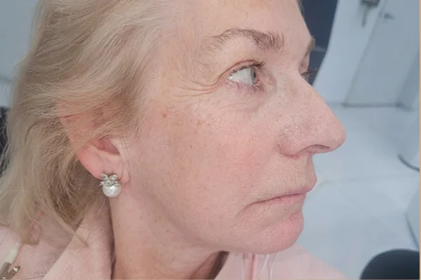 face-dentistry before