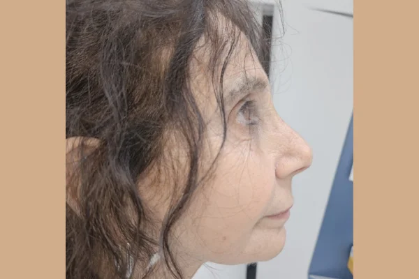 face-dentistry before