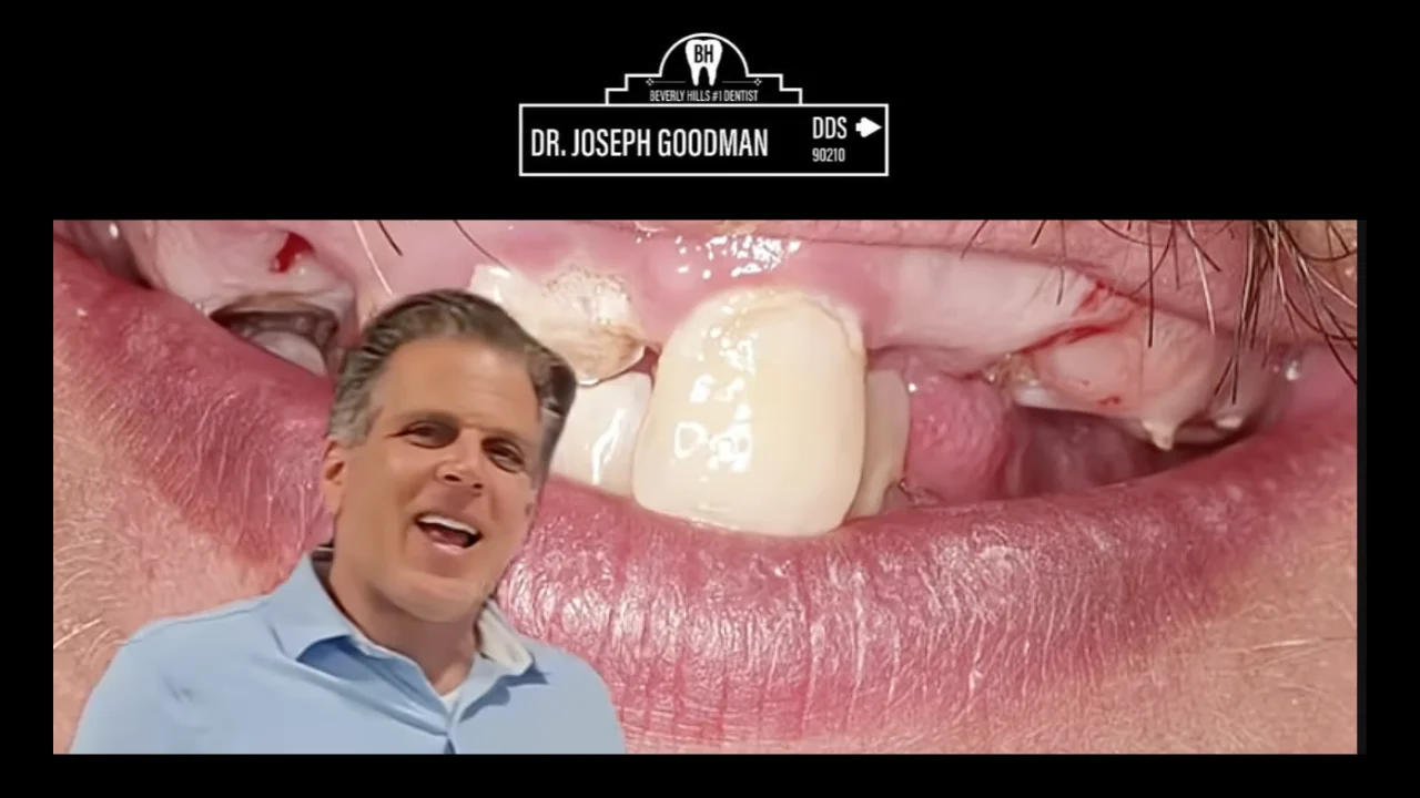 dental implant dentist beverly hills ca, Dr. Joseph Goodman DDS