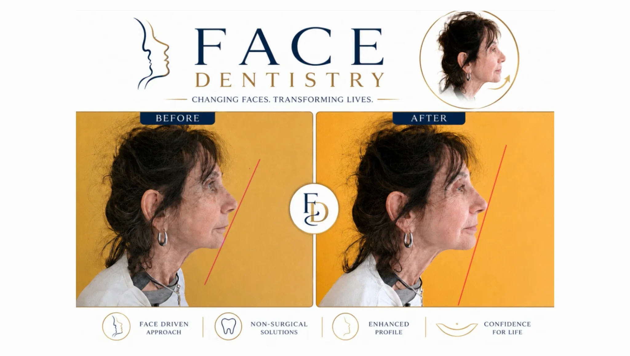 Face dentistry by Dr. Joseph Goodman DDS DMD in beverly hills ca