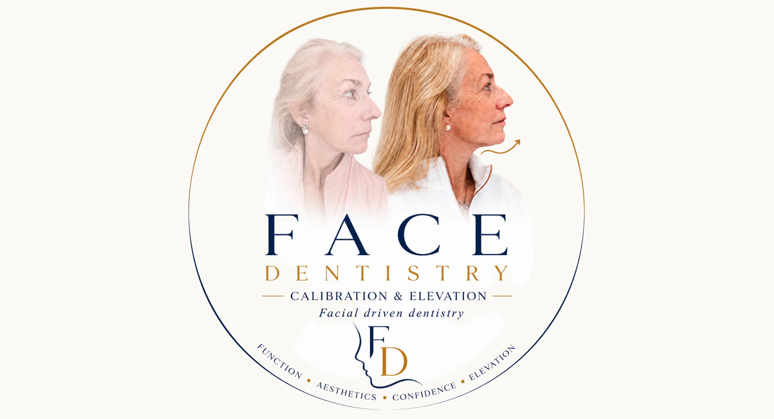 Face Dentistry beverly hills CA, Dr. Joseph Goodman
