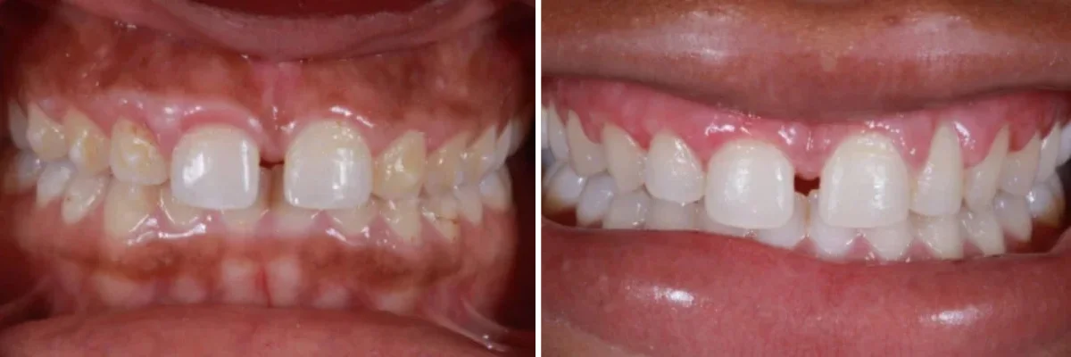 teeth whitening dentist beverly hills ca, Dr. Joseph Goodman DDS