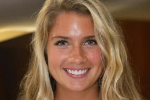Porcelain veneers beverly hills ca, Dr. Joseph Goodman DDS
