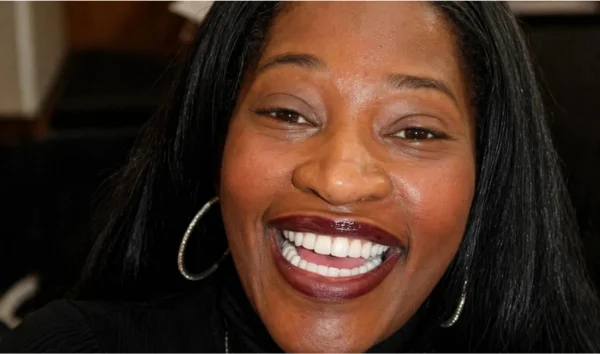 Porcelain veneers beverly hills ca, Dr. Joseph Goodman DDS