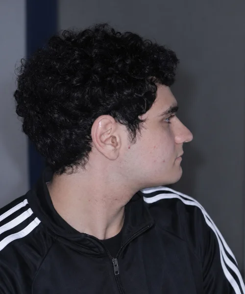 TOP Jaw line is retruded and pushed back