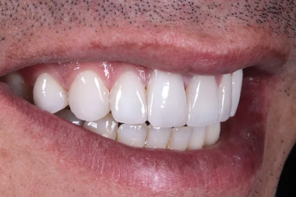 face dentistry beverly hills after