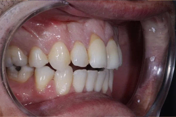 face dentistry beverly hills before